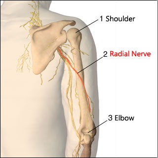 radial-nerve-dysfunction